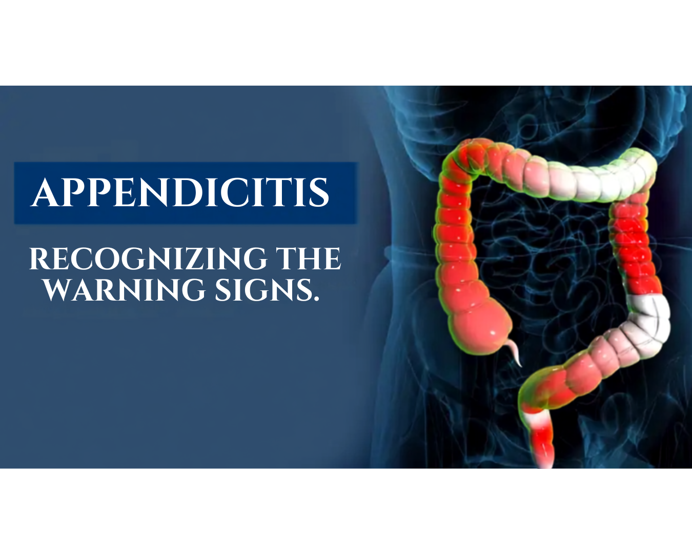 Appendicitis : Recognizing the Warning signs.