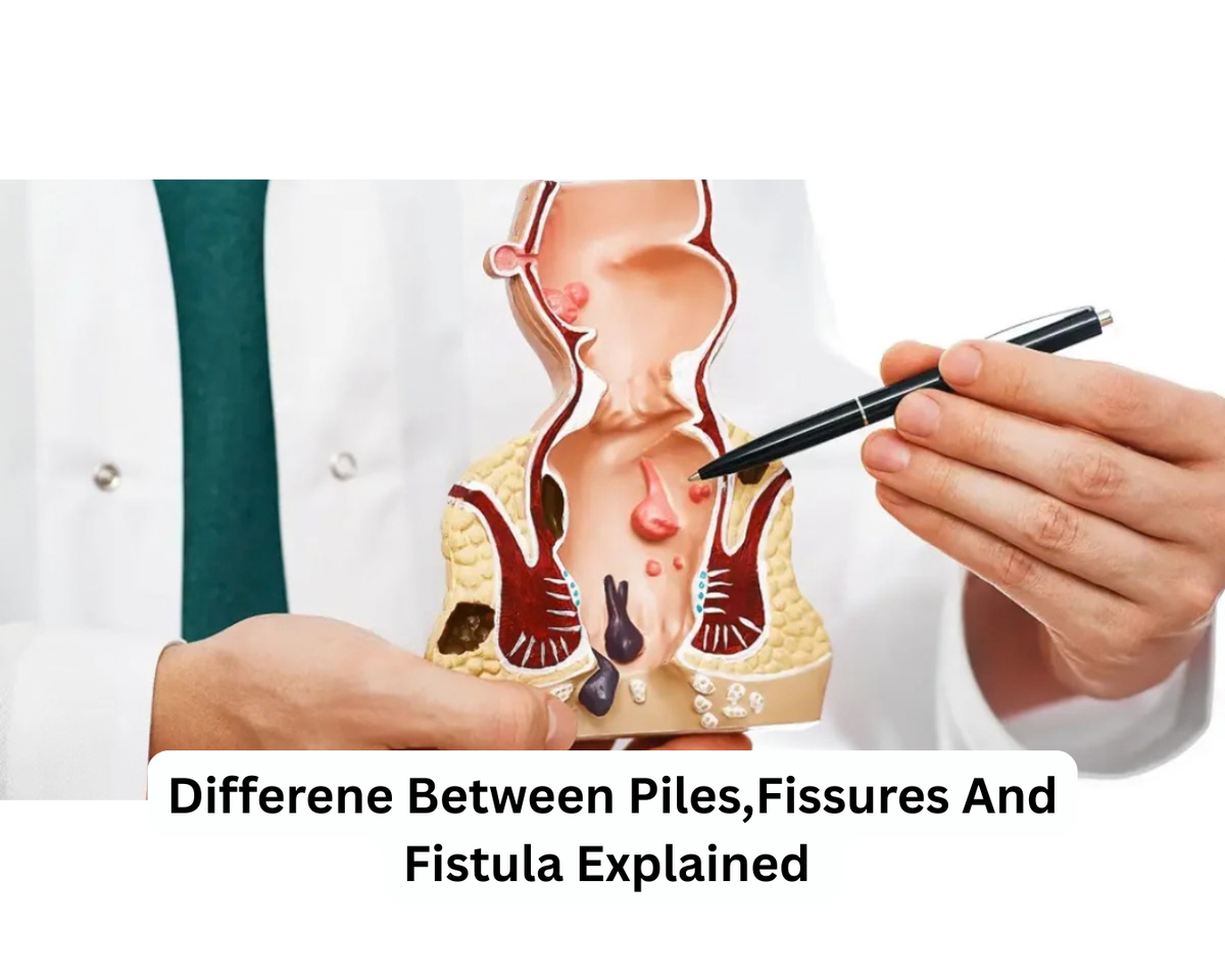 Differene Between Piles,Fissures And Fistula Explained by The Best Colorectal Surhen in Surat
