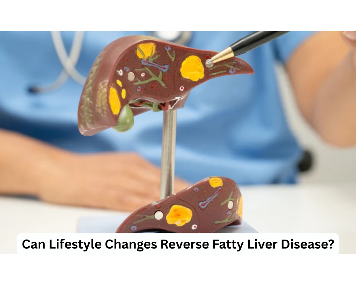 Can Lifestyle Changes Reverse Fatty liver Disease? know It From the best stomach specialist in Surat