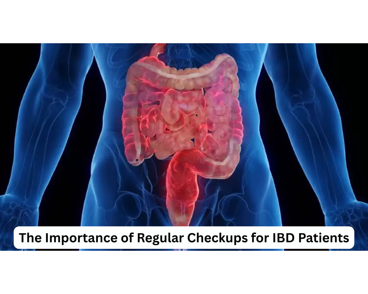 The Importance of Regular Checkups for IBD Patients