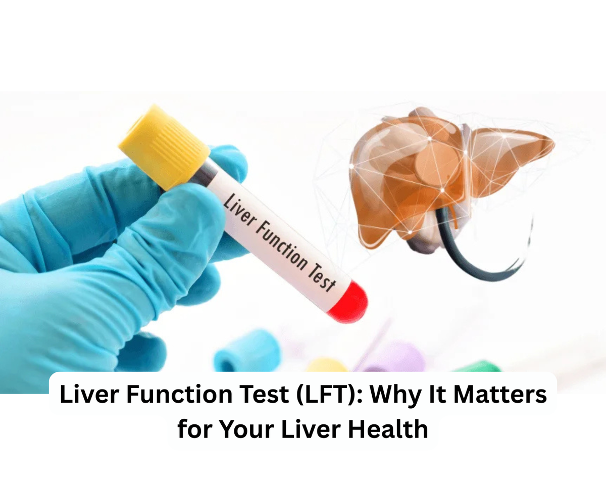 Liver Function Test (LFT): Why It Matters for Your Liver Health