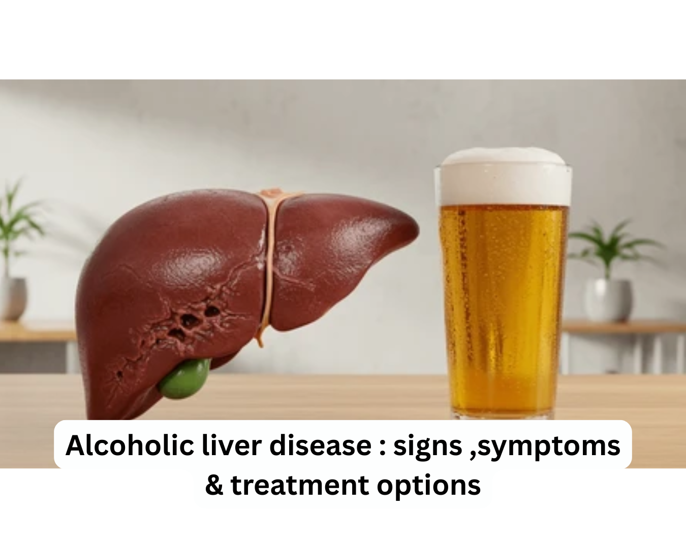 Alcoholic liver disease : signs ,symptoms & treatment options